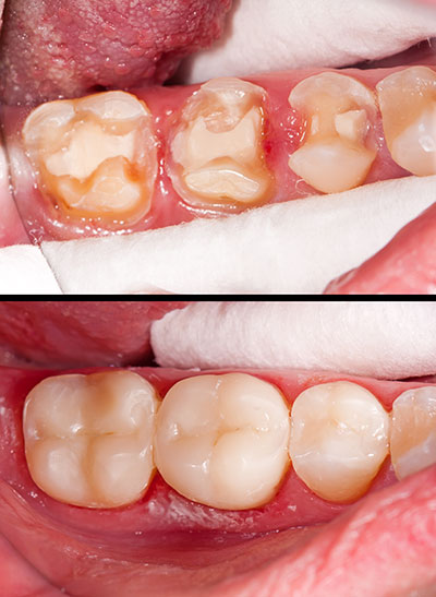 Dentist 02356