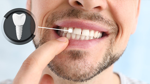 Family Dentist in North Easton